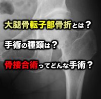 大腿骨転子部骨折とは？手術の種類は？骨接合術ってどんな手術？