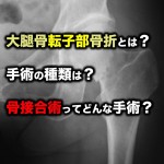 大腿骨転子部骨折とは？手術の種類は？骨接合術ってどんな手術？