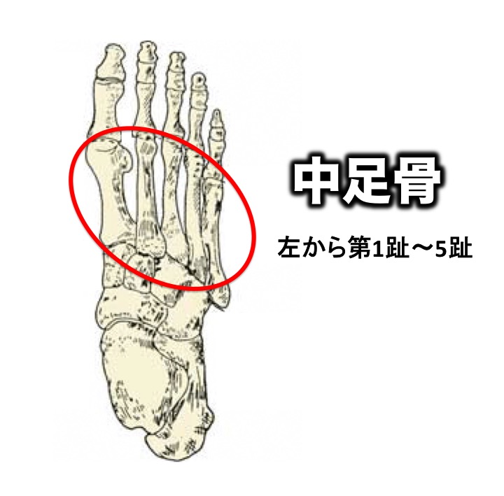 「中足骨骨折」とは?治療期間や全治はどれくらい?