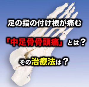 足の指の付け根が痛む 中足骨骨頭痛 とは その治療法は